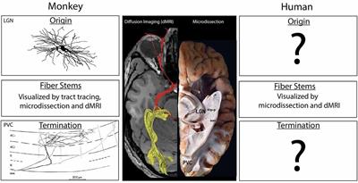 How Human Is Human Connectional Neuroanatomy?